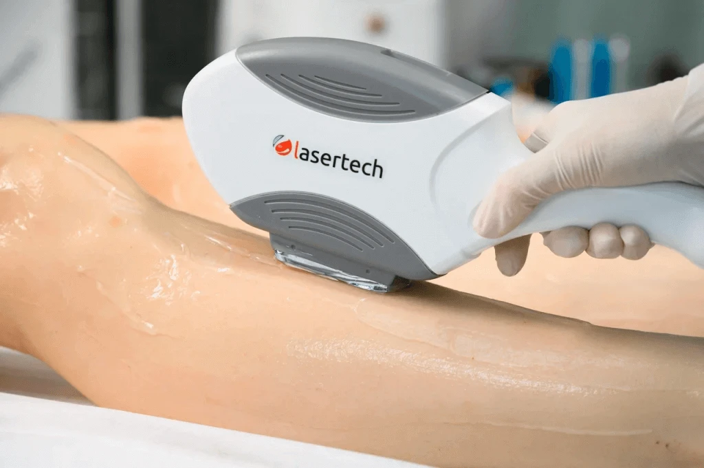 Элос эпилятор Lasertech ELOS